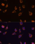 PHLPP2 Polyclonal Antibody