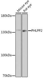 PHLPP2 Antibody in Western Blot (WB)