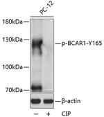 Phospho-BCAR1 (Tyr165) Antibody in Western Blot (WB)