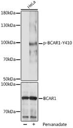 Phospho-BCAR1 (Tyr410) Antibody in Western Blot (WB)
