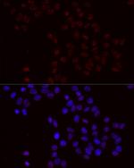 Phospho-BCL2 (Ser70) Polyclonal Antibody