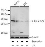 Phospho-BCL2 (Ser70) Antibody in Western Blot (WB)