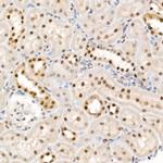 Phospho-4EBP1 (Thr37, Thr46) Antibody in Immunohistochemistry (Paraffin) (IHC (P))