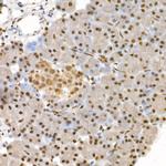 Phospho-4EBP1 (Thr37, Thr46) Antibody in Immunohistochemistry (Paraffin) (IHC (P))