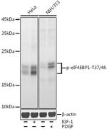 Phospho-4EBP1 (Thr37, Thr46) Antibody in Western Blot (WB)