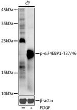 Phospho-4EBP1 (Thr37, Thr46) Antibody in Western Blot (WB)
