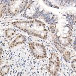 Phospho-4EBP1 (Thr70) Antibody in Immunohistochemistry (Paraffin) (IHC (P))