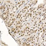 Phospho-4EBP1 (Thr70) Antibody in Immunohistochemistry (Paraffin) (IHC (P))