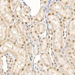 Phospho-4EBP1 (Thr70) Antibody in Immunohistochemistry (Paraffin) (IHC (P))