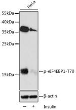 Phospho-4EBP1 (Thr70) Antibody in Western Blot (WB)