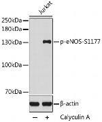 Phospho-eNOS (Ser1177) Antibody in Western Blot (WB)