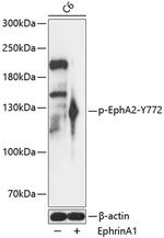Phospho-EphA2 (Tyr772) Antibody in Western Blot (WB)