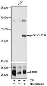 Phospho-FADD (Ser194) Antibody in Western Blot (WB)