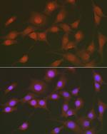 Phospho-FOXO1 (Ser256) Antibody in Immunocytochemistry (ICC/IF)