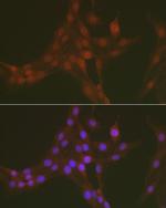 Phospho-FOXO1 (Ser256) Antibody in Immunocytochemistry (ICC/IF)