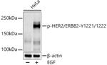 Phospho-ErbB2 (HER-2) (Tyr1221, Tyr1222) Antibody in Western Blot (WB)