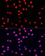 Phospho-Histone H3 (Ser10, Thr11) Antibody in Immunocytochemistry (ICC/IF)