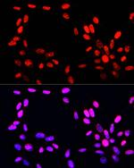 Phospho-Histone H3 (Ser10, Thr11) Antibody in Immunocytochemistry (ICC/IF)