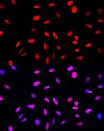 Phospho-Histone H3 (Ser10, Thr11) Antibody in Immunocytochemistry (ICC/IF)