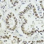 Phospho-Histone H3 (Ser10, Thr11) Antibody in Immunohistochemistry (Paraffin) (IHC (P))