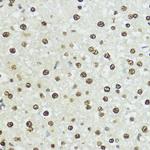Phospho-Histone H3 (Ser10, Thr11) Antibody in Immunohistochemistry (Paraffin) (IHC (P))