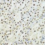 Phospho-Histone H3 (Ser10, Thr11) Antibody in Immunohistochemistry (Paraffin) (IHC (P))