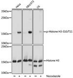 Phospho-Histone H3 (Ser10, Thr11) Antibody in Western Blot (WB)