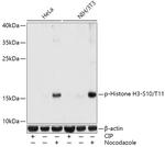 Phospho-Histone H3 (Ser10, Thr11) Antibody in Western Blot (WB)