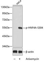 Phospho-HNF4A (Ser304) Polyclonal Antibody