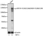 Phospho-IR/IGF1R (Tyr1165, Tyr1166, Tyr1189, Tyr1190) Polyclonal Antibody