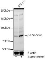 Phospho-HSL (Ser660) Polyclonal Antibody