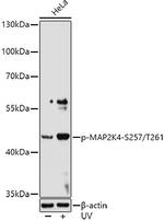 Phospho-MAP2K4 (Ser257, Thr261) Polyclonal Antibody