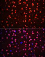 Phospho-p38 MAPK alpha (Thr180, Tyr182) Polyclonal Antibody