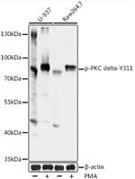 Phospho-PKC delta (Tyr311) Polyclonal Antibody