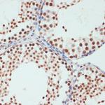 Phospho-POLR2A (Ser5) Antibody in Immunohistochemistry (Paraffin) (IHC (P))