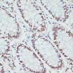 Phospho-POLR2A (Ser5) Antibody in Immunohistochemistry (Paraffin) (IHC (P))