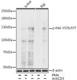 Phospho-FAK (Tyr576, Tyr577) Antibody in Western Blot (WB)