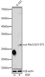 Phospho-RAC1 (Ser71) Polyclonal Antibody