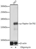 Phospho-Raptor (Ser792) Polyclonal Antibody