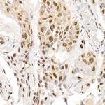 Phospho-SMAD2/SMAD3 (Ser465, Ser467, Ser423, Ser425) Antibody in Immunohistochemistry (Paraffin) (IHC (P))