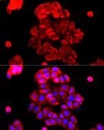PI4KB Antibody in Immunocytochemistry (ICC/IF)