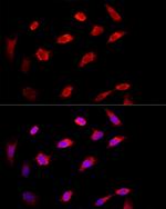 PI4KB Polyclonal Antibody