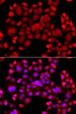PIP4K2B Antibody in Immunocytochemistry (ICC/IF)
