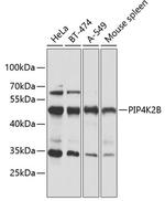 PIP4K2B Antibody in Western Blot (WB)