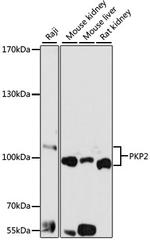 PKP2 Polyclonal Antibody