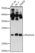 PLA2G2A Polyclonal Antibody