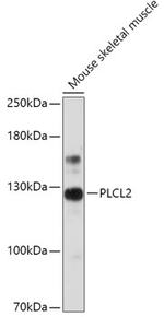 PLCL2 Polyclonal Antibody