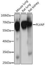 PLVAP Polyclonal Antibody