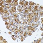 PNLIPRP1 Antibody in Immunohistochemistry (Paraffin) (IHC (P))