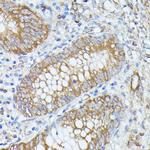 PNLIPRP1 Antibody in Immunohistochemistry (Paraffin) (IHC (P))